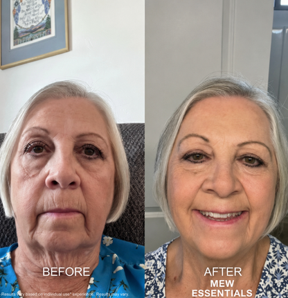 The V Lift Mask™  - Become the Woman Who Loves Her Jawline Again