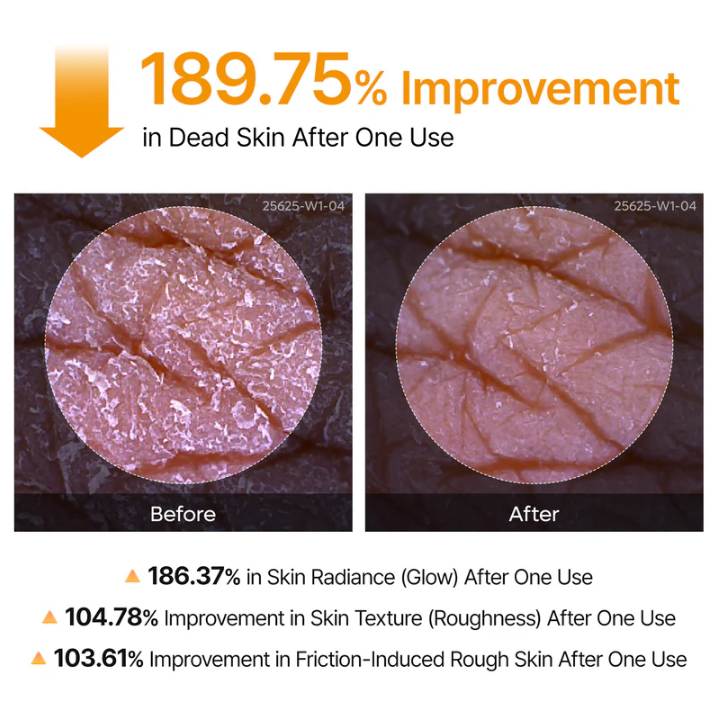 Peel Shot - Kojic & Turmeric Spray